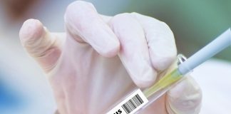 Yaz sıcakları virüsü yavaşlatacak mı?