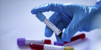 Dünyada koronavirüsten iyileşen sayısı kaç oldu?