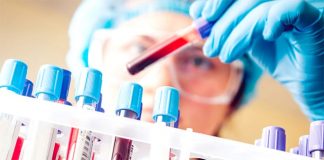 Dikkat çeken araştırma: 50 kanser türü tespit edilecek